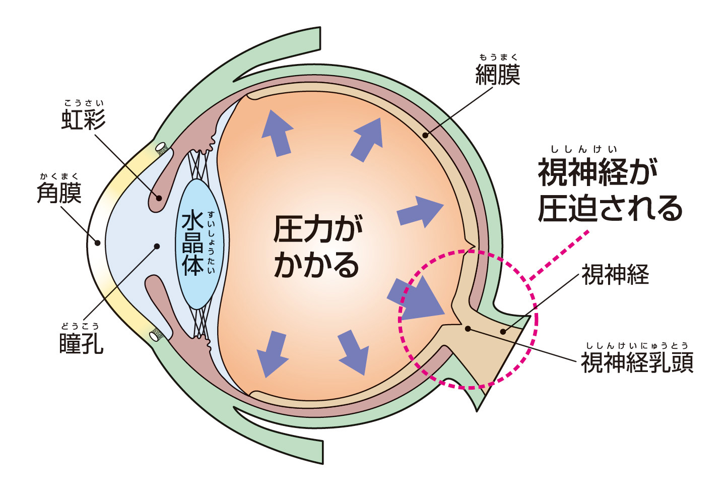 放置すると失明の可能性がある病気