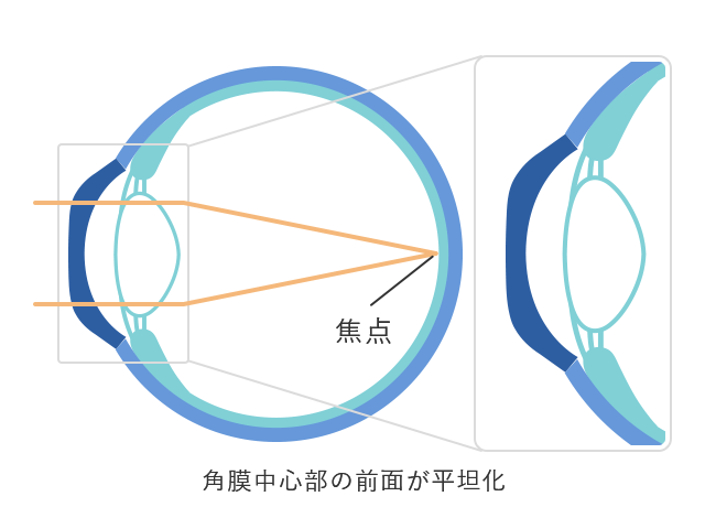 装用後（裸眼時）